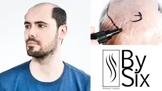 ► BYSIX - Complément capillaire : Réaliser son empreinte