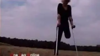 Amputee Christine Showing 2