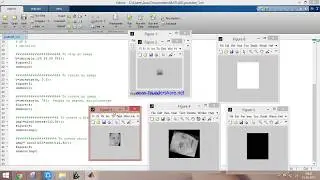 Basic introduction to Image processing using Matlab - Part 1