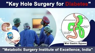 Key Hole Surgery for Diabetes? Metabilic Surgery Institute of Excellence in India.@kskular