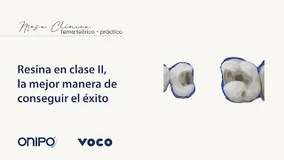 Resina en clase II, la mejor manera de conseguir el éxito