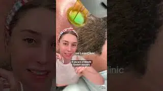Facial Laser Hair Removal Men v. Women 