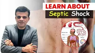 Surviving Septic Shock: The Incredible Resilience Journey #sepsis #pathology
