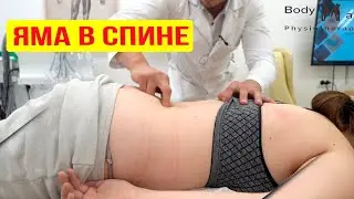 Боль в спине после родов. Болит копчик и крестец. Больно долго сидеть
