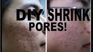 HOW TO SHRINK PORES! DIY PORE MINIMIZING MASK!