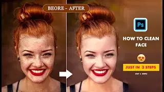 High-end sking softinin photoshop   / Remove Blemishes & Scars / retouching photo / photo edditing