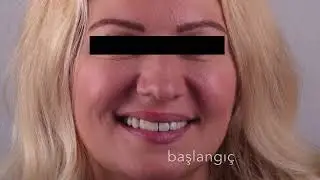 Zinedent'le Değişimi Yakala!