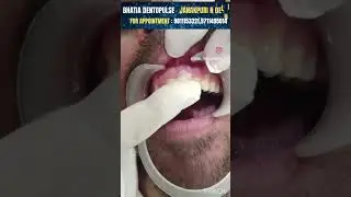 क्या इस टूटे दांत को बचाया जा सकता है ??Can this broken tooth be saved ?? 
