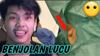 SANGAT TIDAK SATISFYING!! NGELONDRY JERAWAT KETIAK 🤪🤪