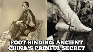 Foot Binding in Ancient China: The Dark History of a Painful Tradition