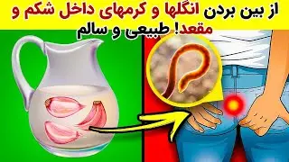 چگونه کرم های روده رو خارج کنیم ! طبیعی و سالم