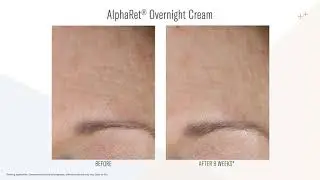 AlphaRet & Intensive AlphaRet  Overnight Cream Application Video