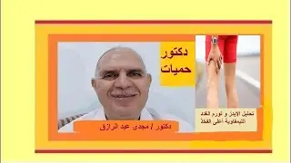 تحليل الإيدز و تورم الغدد الليمفاوية أعلى الفخذ | HIV test