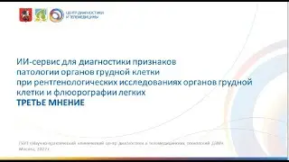 ИИ-сервис для диагностики признаков патологии ОГК при РГ ОГК и флюорографии легких ТРЕТЬЕ МНЕНИЕ