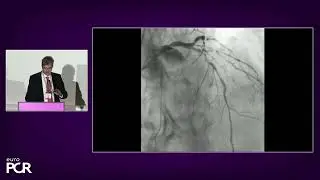 Third generation OCT (HF-OCT): no more limits to the routine clinical use of intravascular imaging