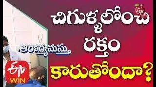 Bleeding Gums  | Bleeding Gums Treatment | Irritated Gums | Bleeding Gums without Brushing