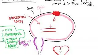 Cushing's Reflex