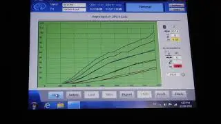 Delphi C2i coding, C2i codificación, codificación de inyector common rail, probador de inyector