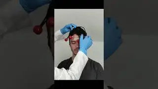 Say goodbye to your headache after this treatment 