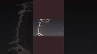 YOUR NERVOUS SYSTEM!
