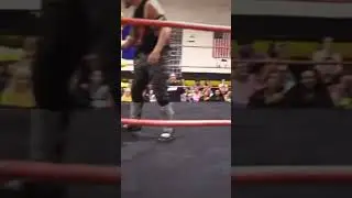 Johnny Patch is losing his hair!!! 