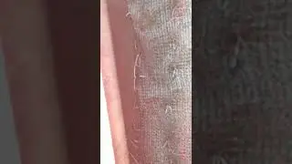 Kümes bitlerine son