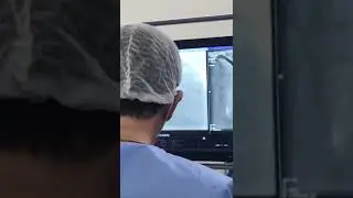 First trail of Lepu Vesscide cutting balloon in Brazil!
