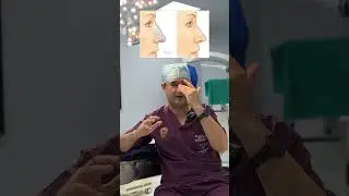 Radiant Beginnings: Bridal & Groom Rhinoplasty Explained by Dr. Nitesh Lamoria