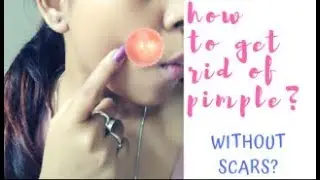 How To Remove Pimples Without Leaving Scars | Removal Permanently | Glam&Glow