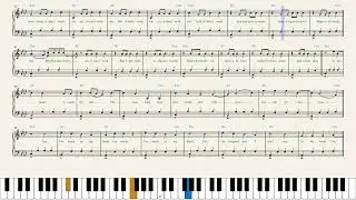 Juice WRLD — In My Head (Piano Sheet Music)