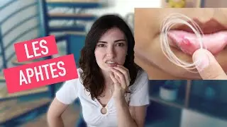How to get rid of a canker sore?