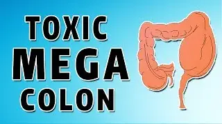 Clostridium Difficile