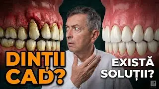 De la gingivită la parodontita - Ce se întâmplă dacă ignori semnele?