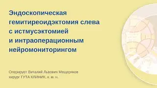 Эндоскопическая гемитиреоидэктомия слева с истмусэктомией и ИОНМ