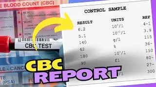 CBC Blood Test Results: How to Read and Understand Your Results