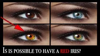 The Genetics of Eye Color | Why Do Eyes Have Color?
