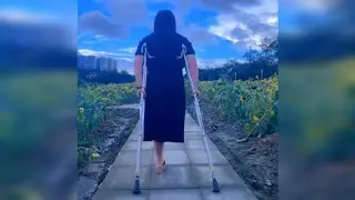 A Walk Through Sunflower Garden | Amputee Girl | One Legged on Crutches