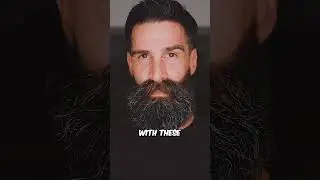 No More Patchy Beard 💪No more receding hairline 🤌 #beard #beardcare #bearded #beardstyle