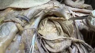 URINARY BLADDER Morphology TRIGONE URETER DUCTUS DEFERENS and Clinicals – Sanjoy Sanyal