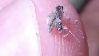 Cleaning my toenail after river fishing day...