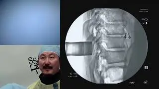 Minimally Invasive Spine Surgery - Jeffrey S. Roh, MD, MBA