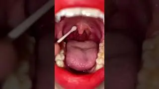 Asmr listik red tongue#youtubeshorts #tongue #asmr #asian #youtube #asian #trending #fyp #viral