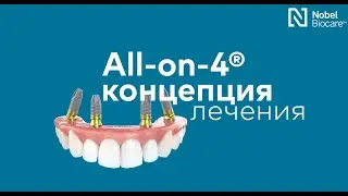 Концепция лечения All-on-4 на оригинальных имплантах Nobel Biocare